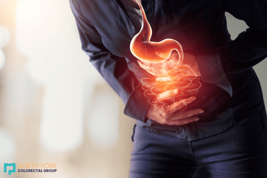 A visual representation of colon cancer symptoms with a person clutching their abdomen where the digestive tract is highlighted in orange to indicate discomfort or pain in that area.